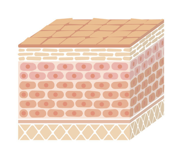 Art showing a square containing layers of skin cells in browns and pinks with damage to top layer; concept is Merkel cell skin cancer